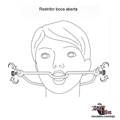 Restritor boca aberta